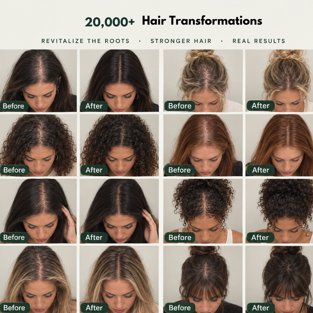 HairBloom™ Korean Scalp Revival Women