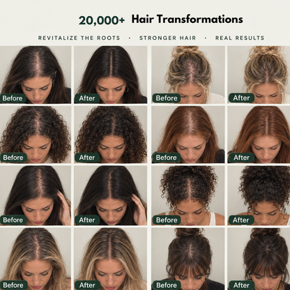 HairBloom™ Korean Scalp Revival Women