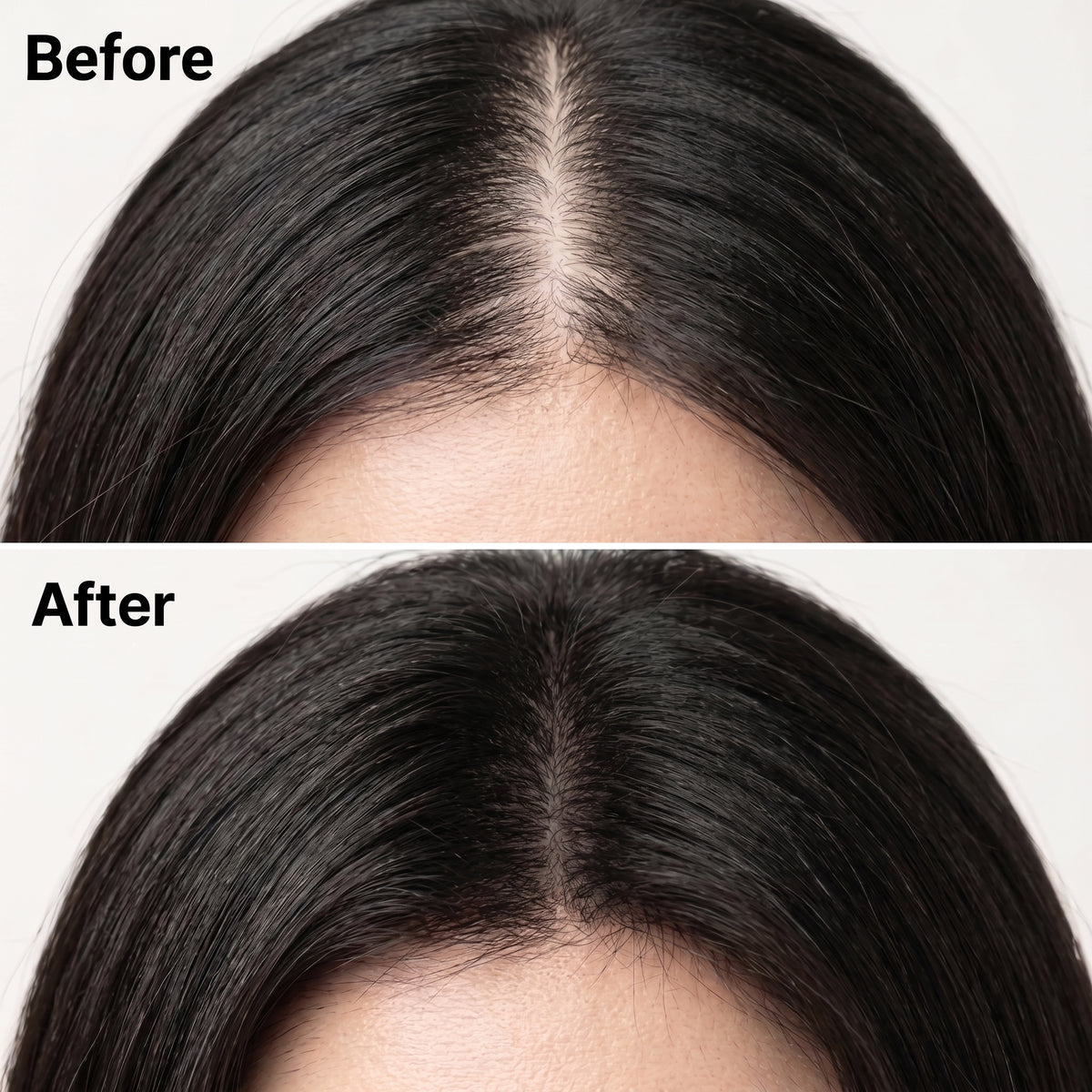 HairBloom™ Korean Scalp Revival Women