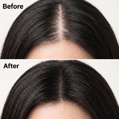 HairBloom™ Korean Scalp Revival Women