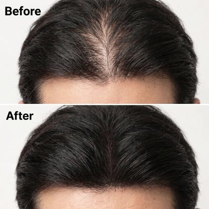HairBloom™ Korean Scalp Revival MEN